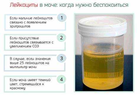 Лечение и коррекция уровня лейкоцитов в анализах