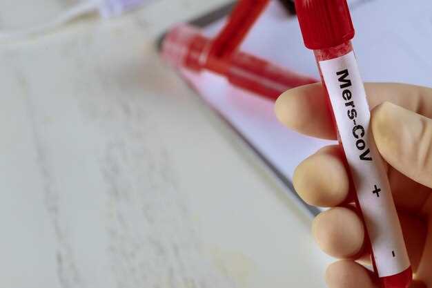 Влияние медикаментов и вредных привычек на уровни алАТ и аст